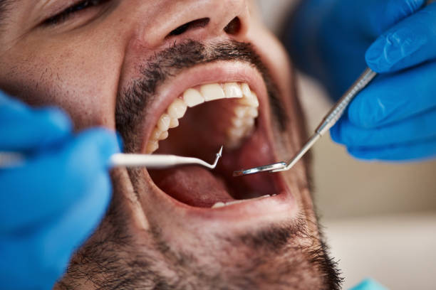 Best Emergency Dentist for Lost Fillings or Crowns in Archer Lodge, NC